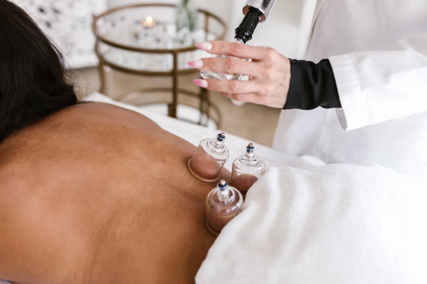Glass cups placed on a client's back during cupping therapy